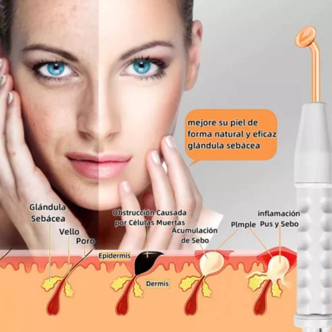 Máquina Alta Frecuencia Facial